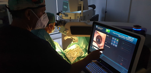 Quirónsalud Málaga incorpora el láser refractivo más avanzado y personalizado del mercado Quirónsalud Málaga incorpora el láser refractivo más avanzado y personalizado del mercado